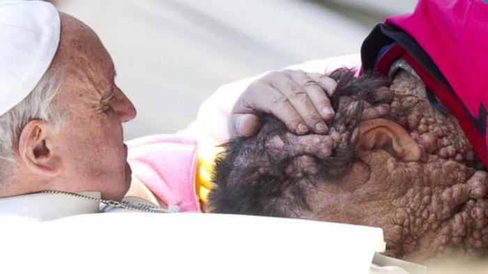  Pope Francis embraces Vinicio Riva, a man scarred by a genetic disease. This was one of many progressive acts that the new leader of the Church made. [2013] Source: EPA